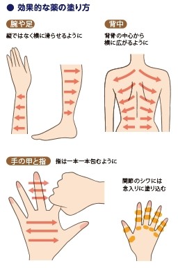 効果的な薬の塗り方